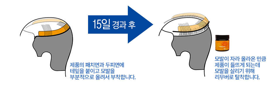 T.S.G.(Tape Sandwich Grafting)설명